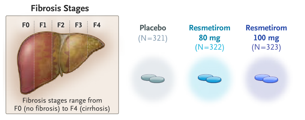 resmetirom